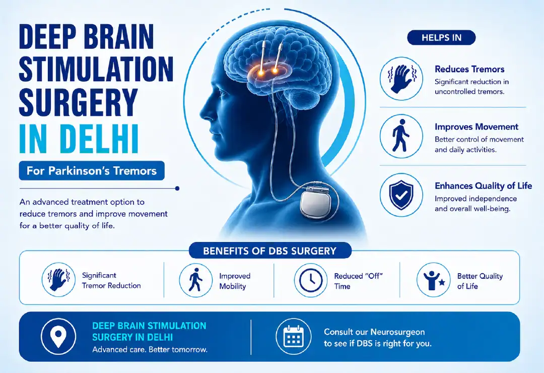 Deep Brain Stimulation Surgery in Delhi for Parkinson’s Tremors